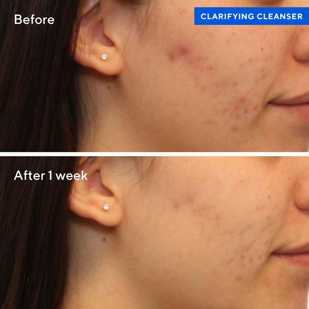 Lookfantastic Murad Clarifying Skin Cleanser Gel (klärendes Reinigungsgel) 200ml