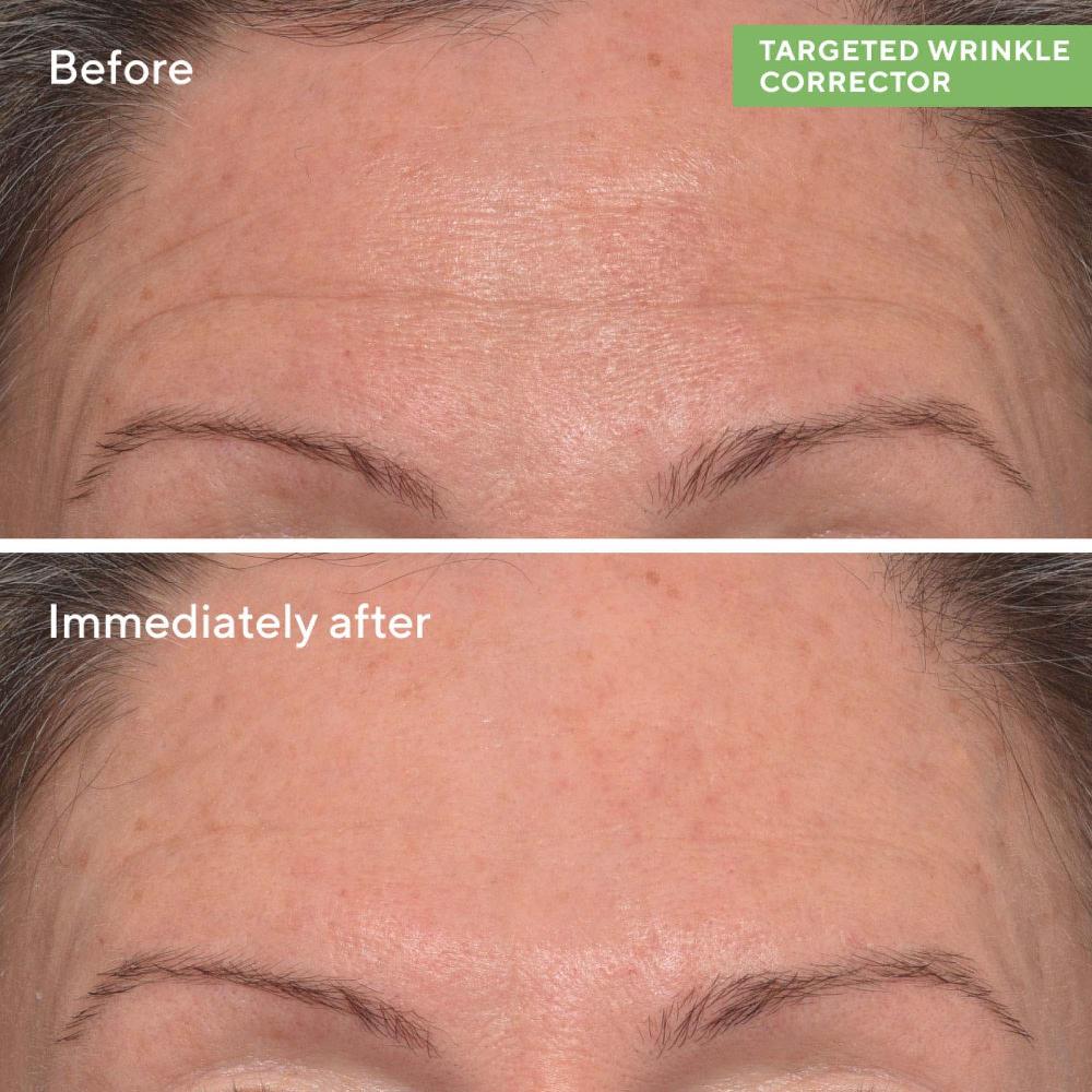 Lookfantastic Murad Gezielter Falten-Concealer 15 Ml