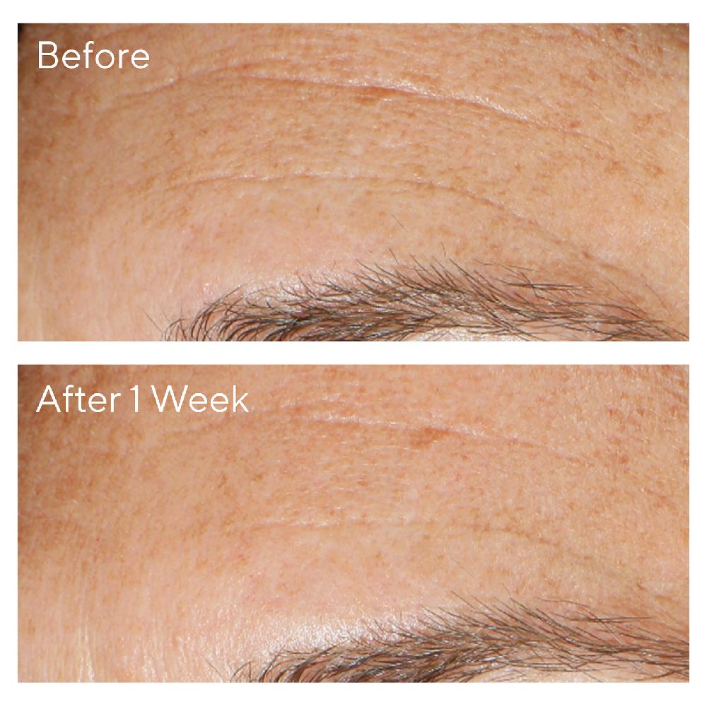 Lookfantastic Murad Replenishing Multi-Acid Peel 100ml