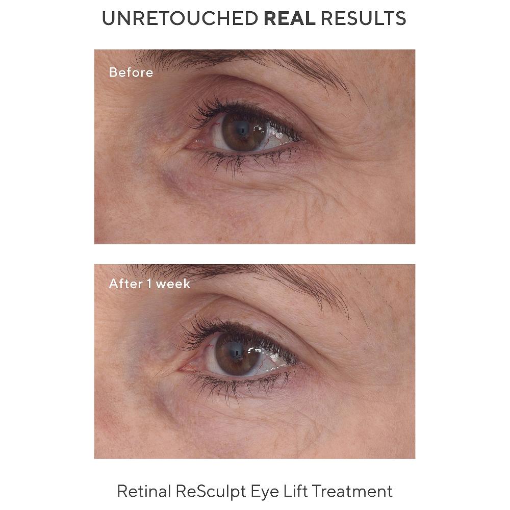 Lookfantastic Murad Retinal ReSculpt Augenbehandlung 15 Ml