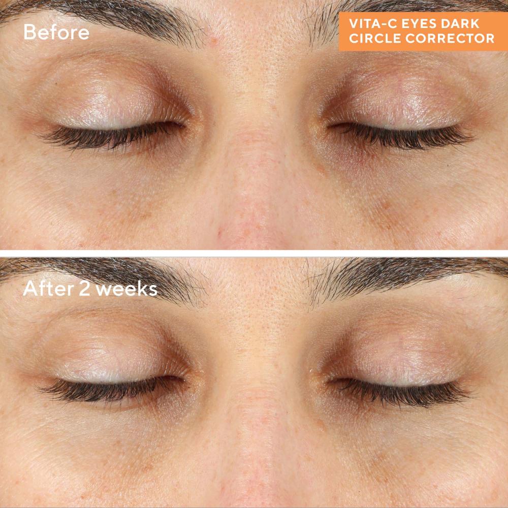 Lookfantastic Murad Vita-C Eyes Concealer Gegen Augenringe 15 Ml