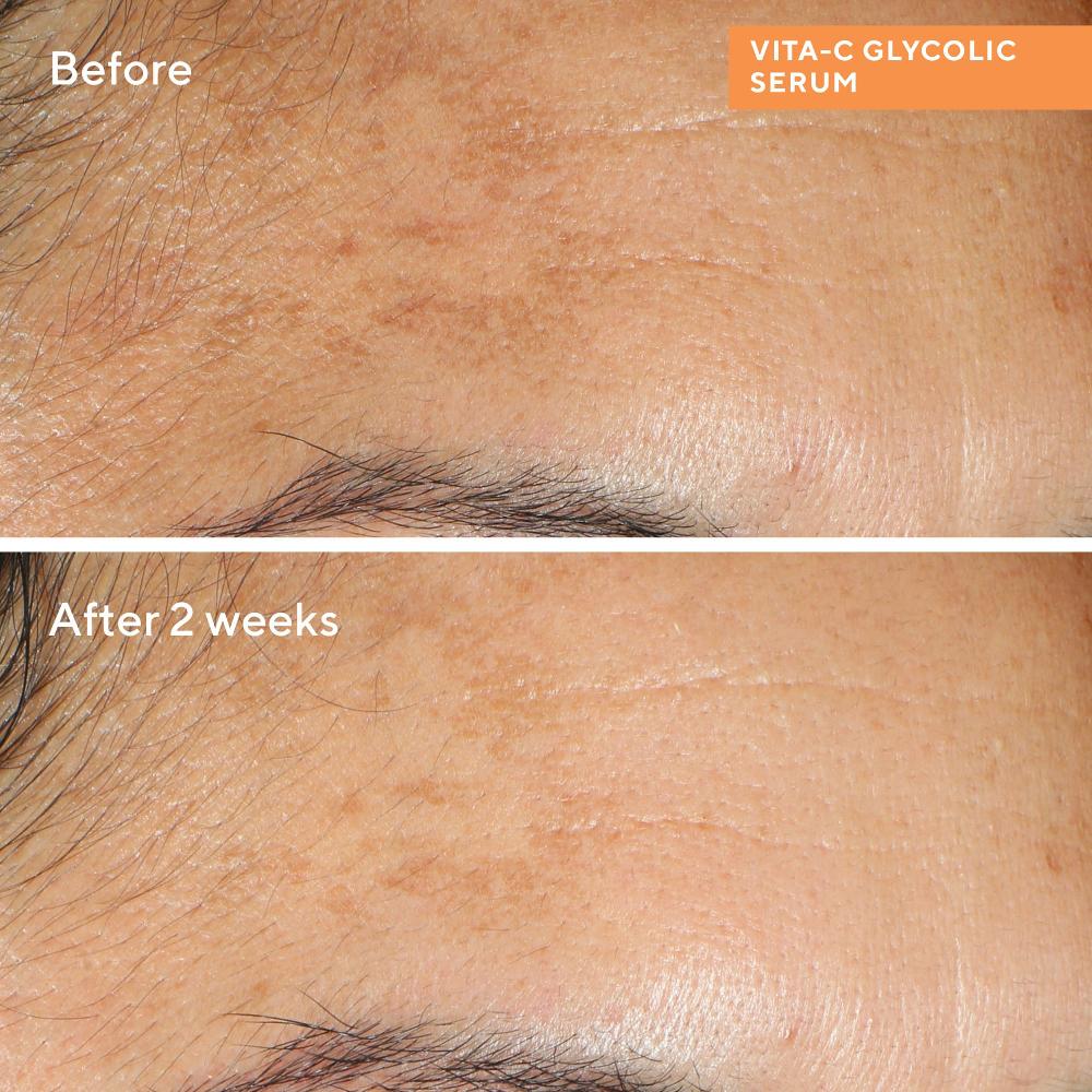 Lookfantastic Murad Vita-C Glycolic Aufhellendes Serum 30 Ml