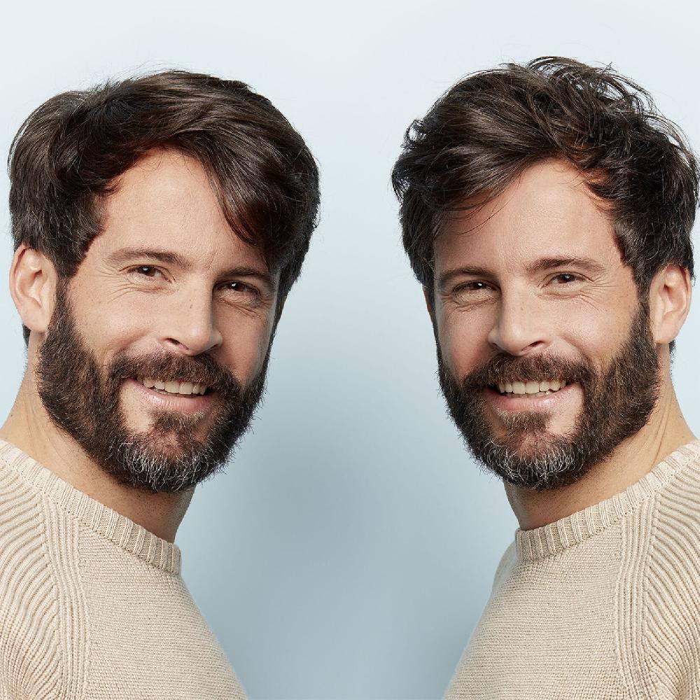 Lookfantastic NIOXIN 3-Part System 2 Kopfhaut- Und Haarkur Für Natürliches Haar Mit Fortgeschrittener Ausdünnung 100ml