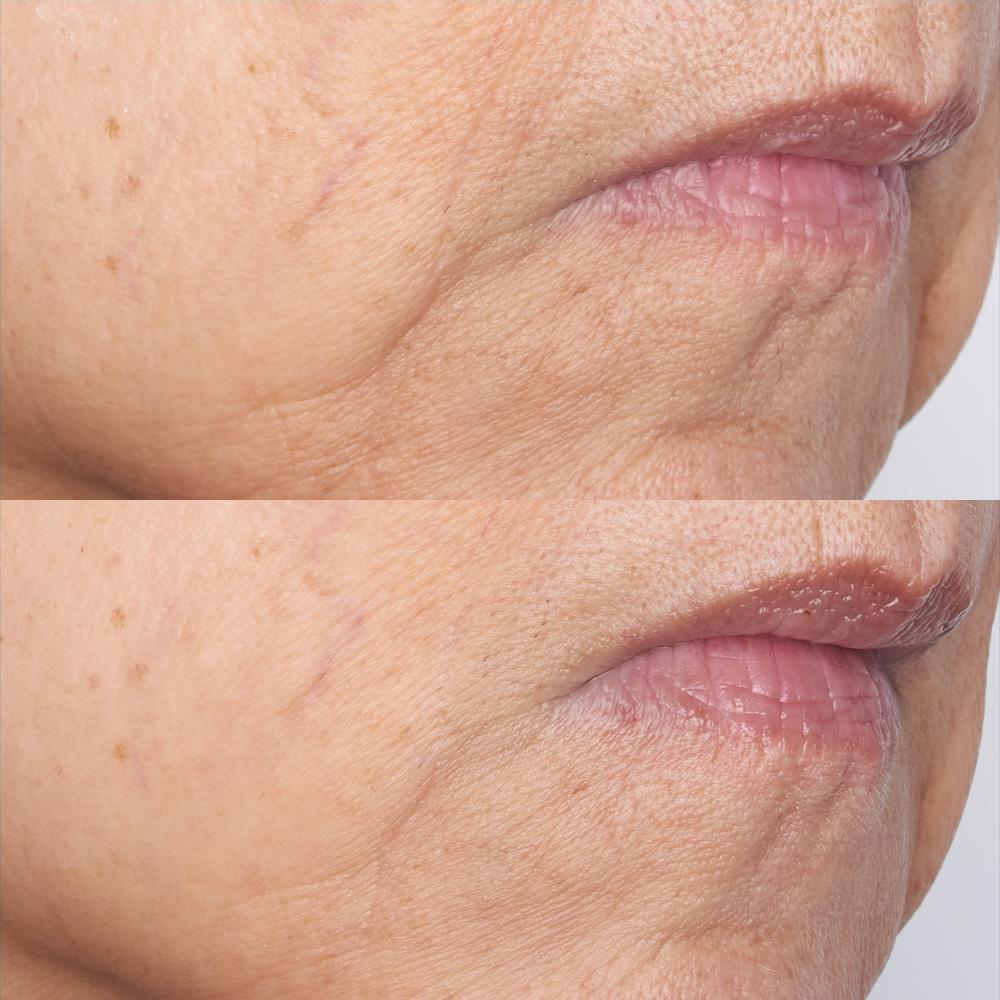Lookfantastic Perricone MD Cold Plasma Plus+ The Intensive Gel Mask