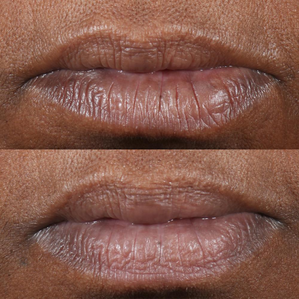 Lookfantastic Perricone MD CP+ Lip Therapy 0.15 Oz FG