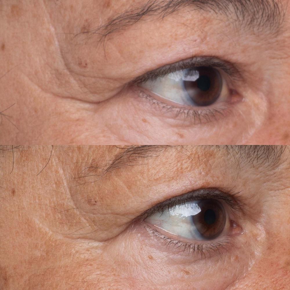 Lookfantastic Perricone MD High Potency Growth Factor Firming & Lifting Eye Serum 0.5oz FG