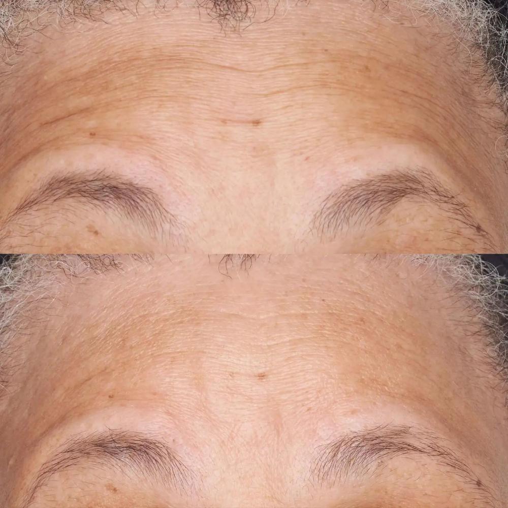 Lookfantastic Perricone MD Hypo Clean Correction Barrier Repair Nourishing Moisturizer 2oz FG