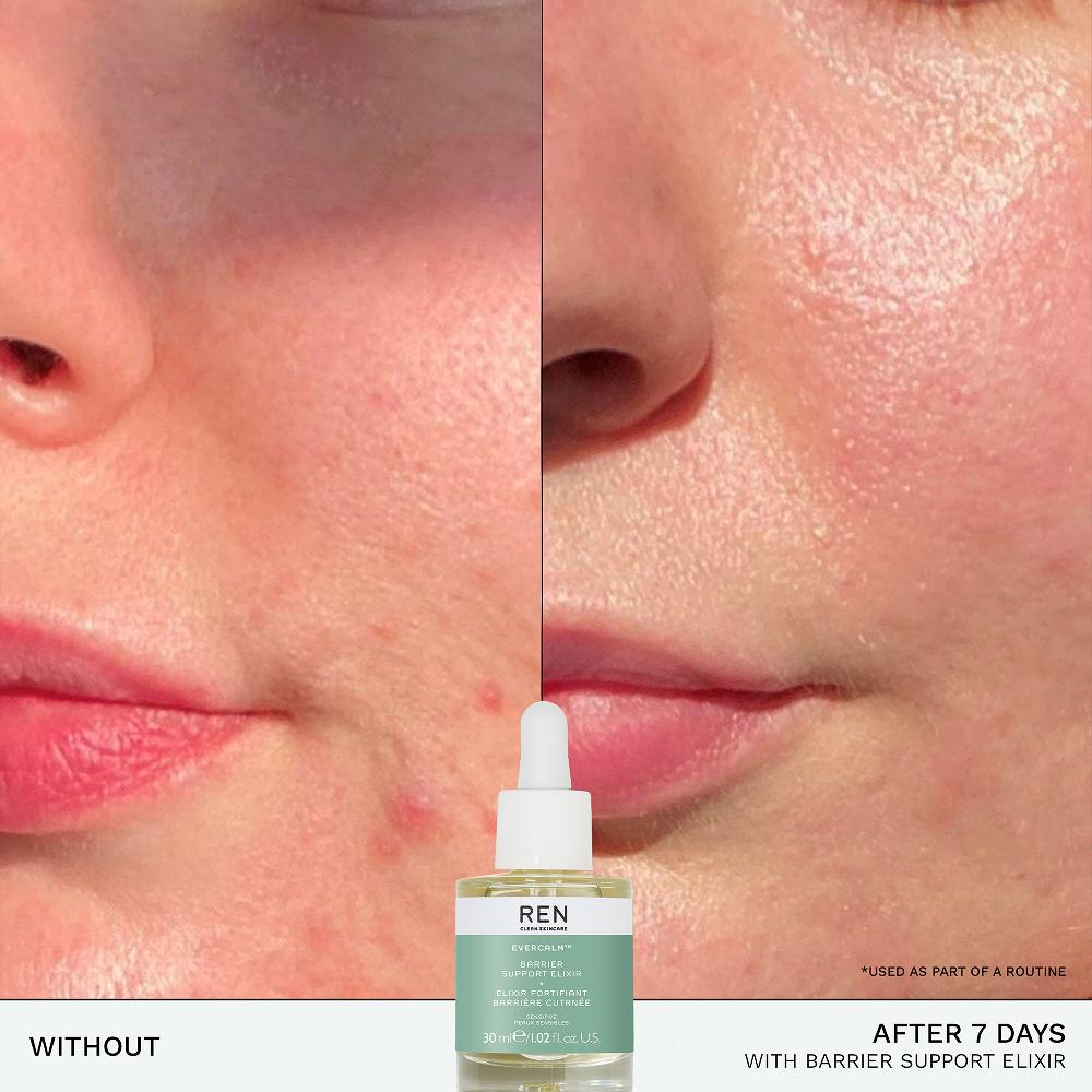 Lookfantastic REN Clean Skincare Evercalm Barrier Support Elixir 30 Ml