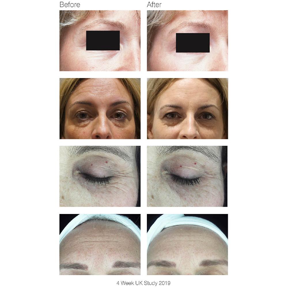 Lookfantastic Rio FaceLite Beauty Boosting LED Gesichtsmaske