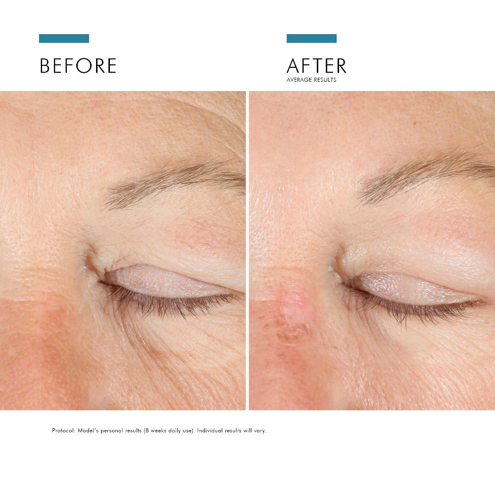 Lookfantastic SkinCeuticals A.G.E. Hochentwickelte Augenpflege Gegen Augenringe & Falten 15 Ml