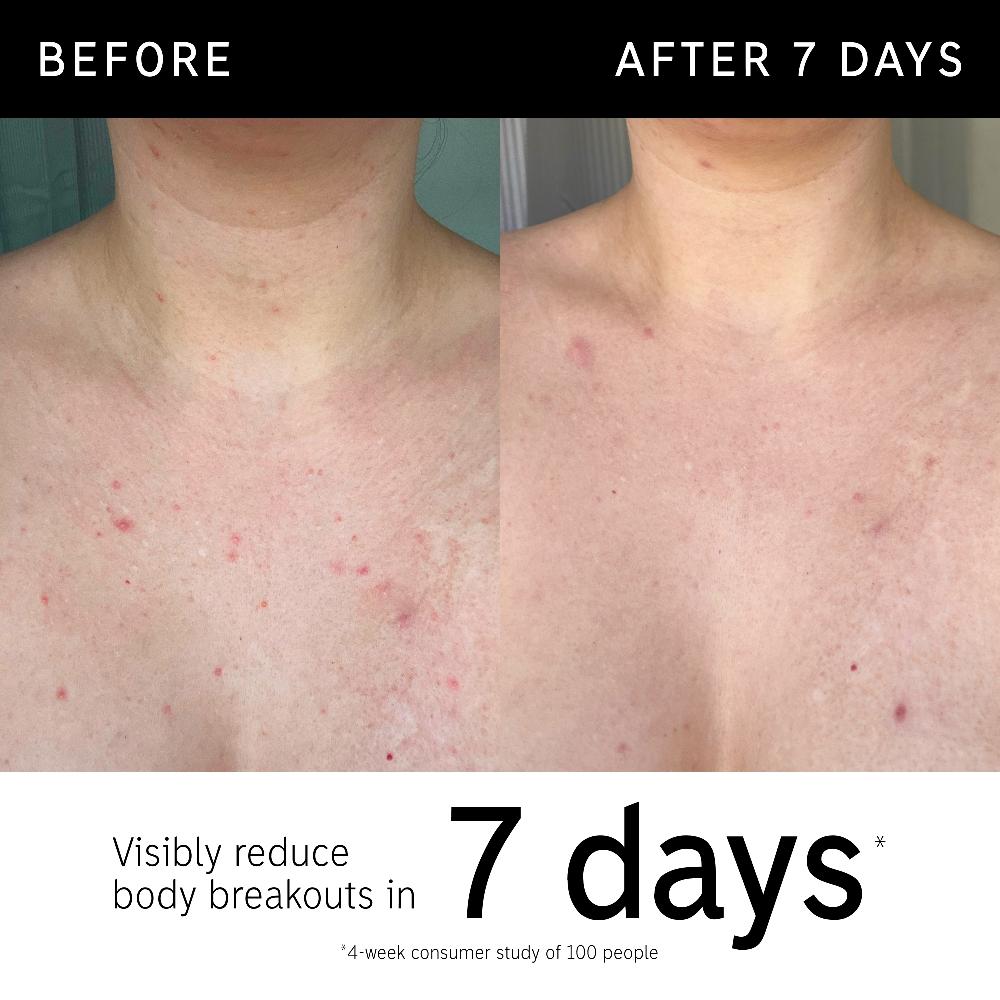 Lookfantastic The INKEY List Glycolsäure-Körperpeeling-Stift 45 G