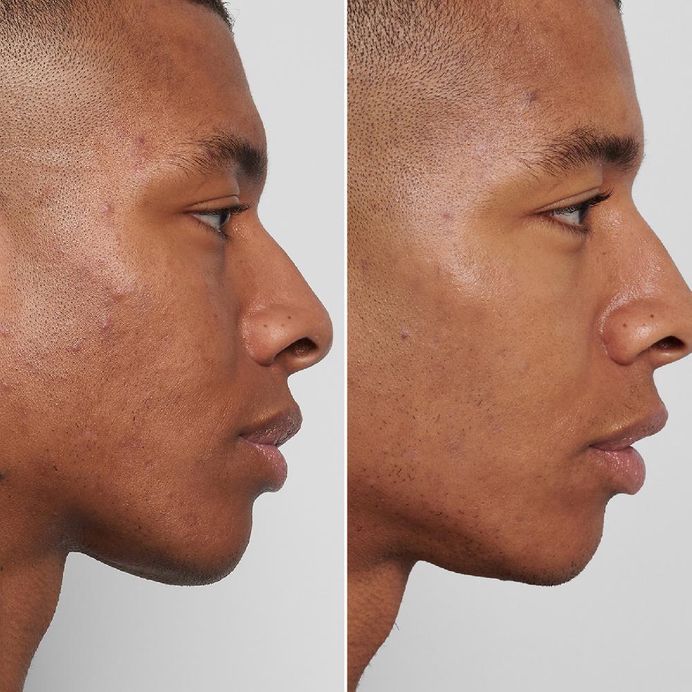 Lookfantastic The INKEY List Mandelic Acid Treatment 15ml