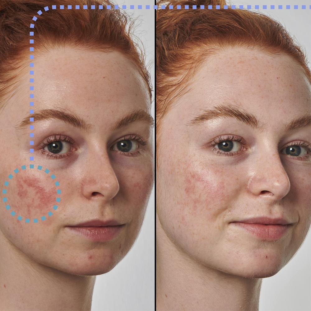 Lookfantastic The INKEY List Super Solutions 10 % Azelainsäure-Serum 30 Ml