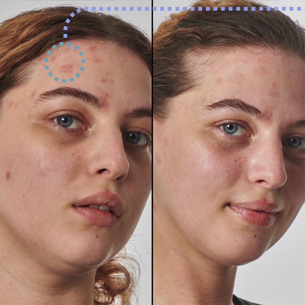 Lookfantastic The INKEY List Super Solutions 10 % Urea Feuchtigkeitspflege 50 Ml