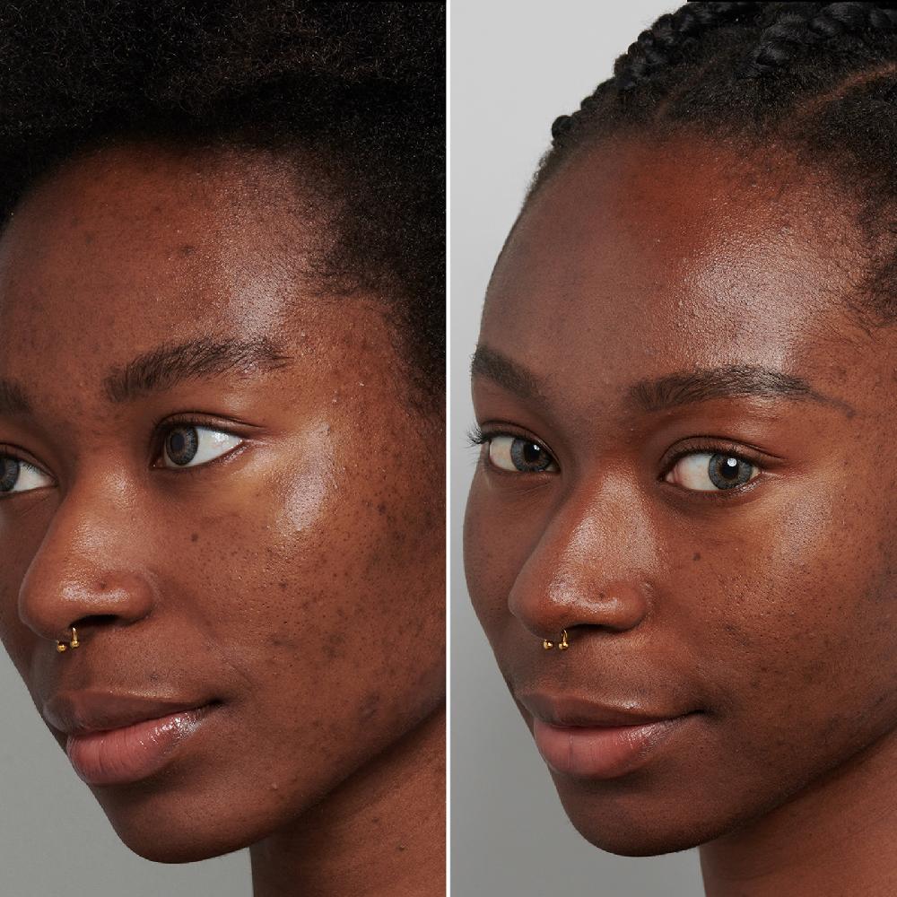 Lookfantastic The INKEY List Tranexamic Acid Serum 30 Ml