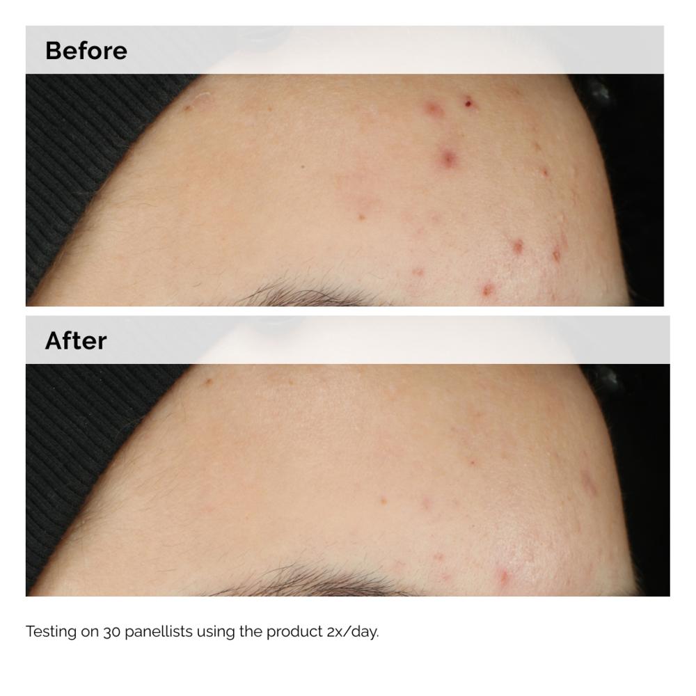 Lookfantastic The Ordinary Ausgleichendes Und Klärendes Serum 30 Ml