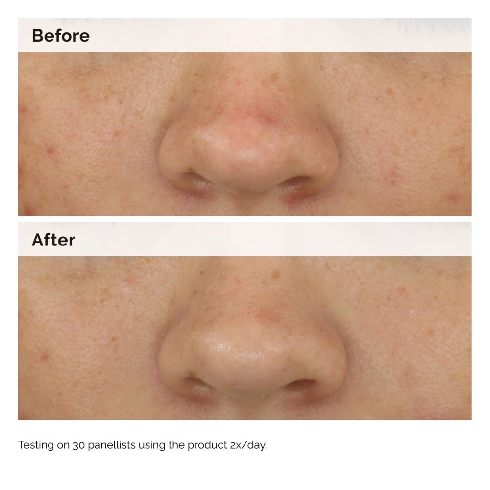 Lookfantastic The Ordinary Ausgleichendes Und Klärendes Serum 30 Ml